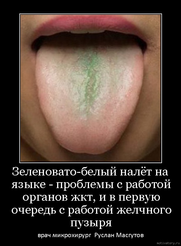 Зеленовато-белый налёт на языке - проблемы с работой органов жкт, и в первую очередь с работой желчного пузыря